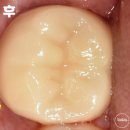 보강치과기공소 이미지