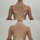 대구 예비신부 피부관리 티나나에스테틱 물방울관리 받았는데 상체관리까지 ?