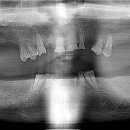 림플란트치과의원 이미지