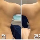 서윤피부맑음 강남구청역점