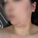 신명상가 | 마석 에스테틱 테네르 신부관리 추천 리프팅 텔프팅 후기