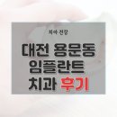 대전시 서구 용문동 치과 임플란트 가격 및 후기와 추천 병원 6곳