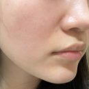 을-100 | 30대의 최대 고민 팔자주름.. 을! 위한 100% 내 돈 “쥬베룩볼륨” 후기