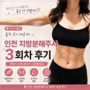 차 | 인천 지방분해주사 3회차 팔뚝 후기