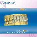 리더스기공소 이미지