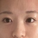 거룡6길 1, (용산동) | [충주 에스테틱 추천] 충주 피부관리 맛집 '원스킨'에서 홍조 톤업 리프팅까지 솔직 후기 !