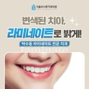 신당역라미네이트 부작용이 걱정된다면? 안전하게 받는 방법