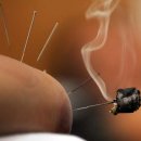 직지한의원 이미지