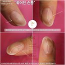 라온네일클리닉