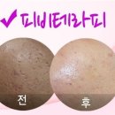 피비한의원 네이버블로그
