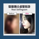 탑클래스성형외과의원 이미지