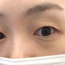 오드아