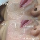 하이토탈뷰티 이미지