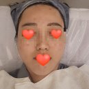 (주)현진메디칼 | 구미에스테틱후기1. 옥계동 피부관리 물방울리프팅 받았어요. 빛나다