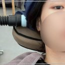 동탄탈모두피본연 이미지