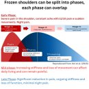 Frozen Shoulder) 증상, 방치하면 안 되는 이유, 송파PT 50대 남성 어깨 통증 - FE트레이닝센터 송파점