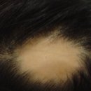 하이테디 이미지