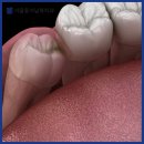 불로치과의원 이미지