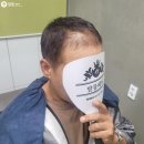 부산 사하구 명지증모술 넓은 이마 발몽헤어에서 해결