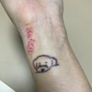 읻다의원 | 🩵 읻다의원 문신 제거 3회차 후기