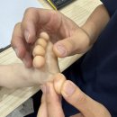 아이피부과의원 | 아이 발가락 굳은살? 명지 내과의원, 피부과 방문 후기와 치료법 소개