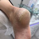 푸스케어 원주점 | 원주발각질 푸스케어 원주점 남편발관리 후기