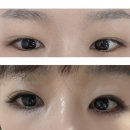 더제이메디칼 | 선릉 LED 연장 LED 속눈썹 언더래쉬 유지력 좋은 네추럴제이