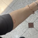 양악수술 후기 (양악 전 검사, 양악퇴원까지의 기록)