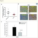 오스본병원 | [잠실 피부과전문의]알쓸피잡 오젬픽페이스 이야기: 위고비, 마운자로가 얼굴 노화의 주범?