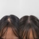 덕소사우나 | 덕소가르마두피문신 가르마 바꿔도 티 나는 탈모 해결할 수 있을까