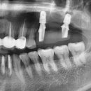 진천치과기공소 이미지