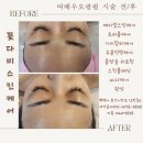 오광케어 이미지