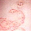 백선세탁 이미지