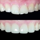 이세상치과기공소 이미지