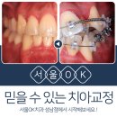 OK치과기공소 이미지