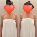 청담 신부관리 디유에스테틱 웨딩 팔 슬리밍관리 후기