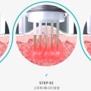클린업피부과의원 이미지
