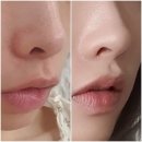 NK테크 | 수술없이 중안부 축소, 모공 축소 가능한 리엔케이 콜라겐 미드샷 앰플 후기