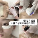 노원 피부관리 처음이라면? 가성비 + 효과 짱인 사심뷰티에스테틱 후기
