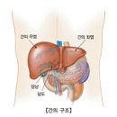 간경화와 복수 이미지