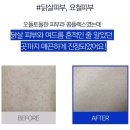 내모메는 | 모공각화증에 좋은 내모메 바디로션 사용 찐 후기