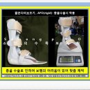 소망의수족보조기 이미지