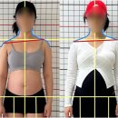 이로운마취통증의학과의원 | 허리 걱정 끝! 부산연산동필라테스, 척추측만 교정과 프리미엄 개인레슨의 새로운 기준