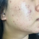 씨유청주동남LH점 | &lt;청주 동남지구 피부관리&gt;주뷰티 물방울리프팅+원데이필링