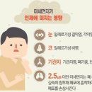 [기획] 미세먼지의 역습…황사는 억울하다.황사는 중국내륙 위치한 내몽골사막 강풍으로 모래 흙먼지로 토양성분,미세먼지는 화석연료 연소 후 공기와 반응 이미지