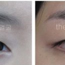 The예쁜손