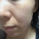 진Pro | EOA 풀텐자 풀쎄라PRO 후기 | 결혼 준비 모공·윤곽 홈케어 디바이스 내돈내산