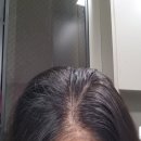 와우2 | 출산 후 탈모 토닉 추천 쓰리와우 영지버섯 헤어토닉 사용 후기