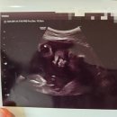 🌟송파고은빛 출산∙이용 후기🌟(오소영 원장님, 초산모 자연분만, 병실 컨디션, 신생아 관리, 병원...