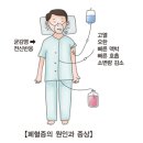 패혈증 이미지